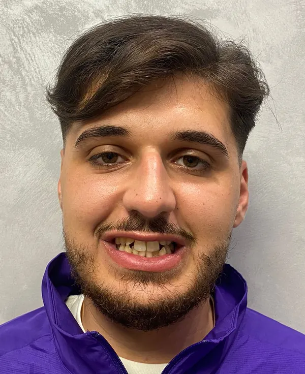 Giovanni, prima del trattamento