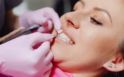 Faccette dentali in ceramica