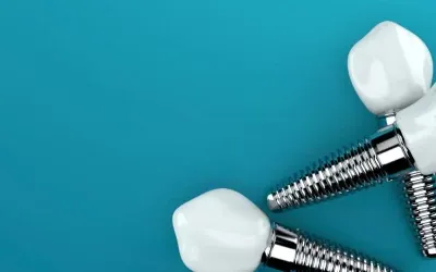 Impianti dentali in titanio
