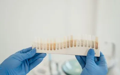 Sbiancamento dentale: cosa aspettarsi