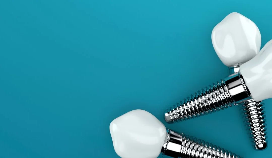 impianti dentali, impianti in titanio, impianti in zirconio, differenza titanio zirconio, implantologia dentale